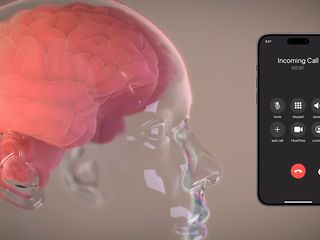 thumbnail - Neuralink Trial